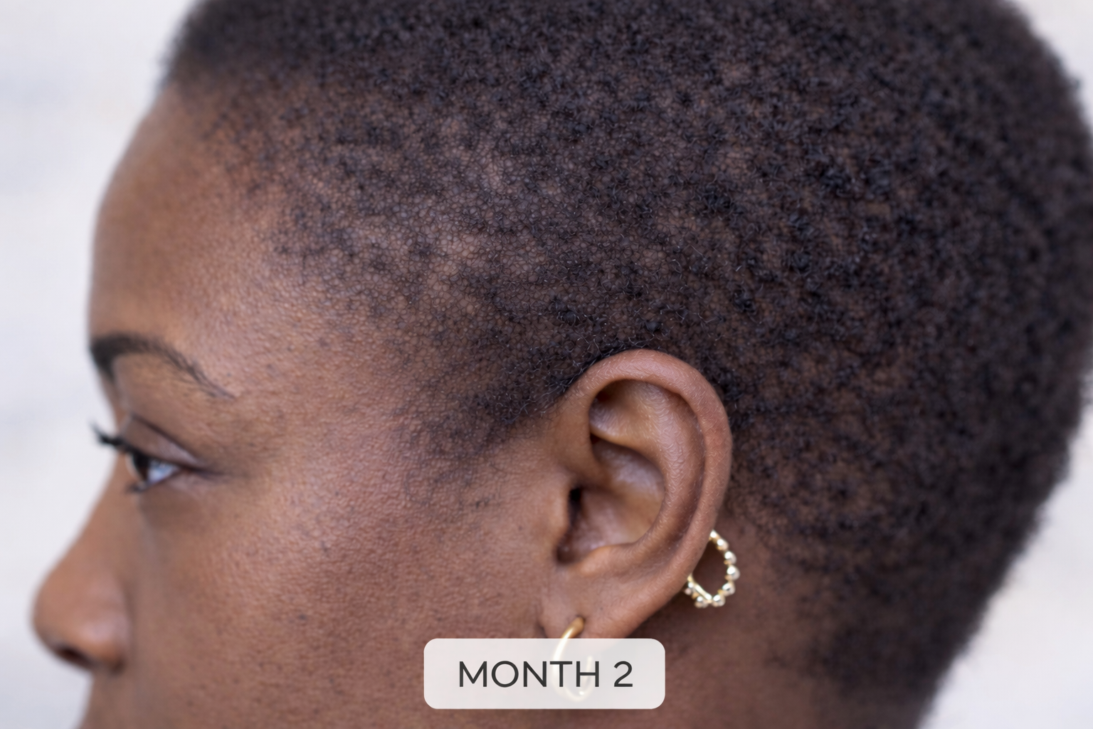 THE PEN
Multi-Complex Scalp Treatment
Powered by Strength Complex™ | 300,000 PPM